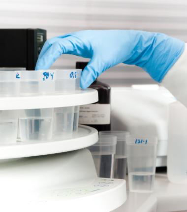 Laboratoriehånd i blå Granberg 951 nitrilhanske plasserer prøvebeger på analyseringskarusell